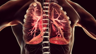 Mai Negativ decât fumatul: afectează plămânii