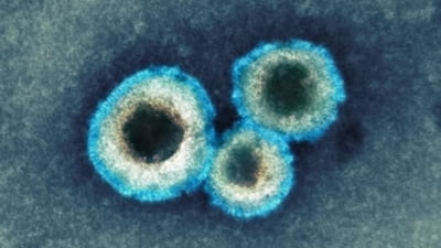 Metapneumovirus: gravitate și tratament