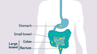 Sfat genial: O băutură zilnică te apără de cancer