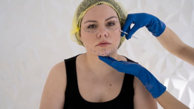 Persoană publică mutilată de estetice