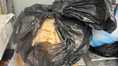 Elevi de la școală exclusivistă, la spital