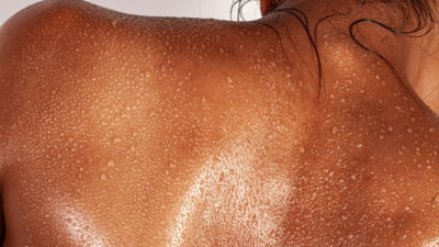 Nivel Sus de radiații UV: protecție necesară